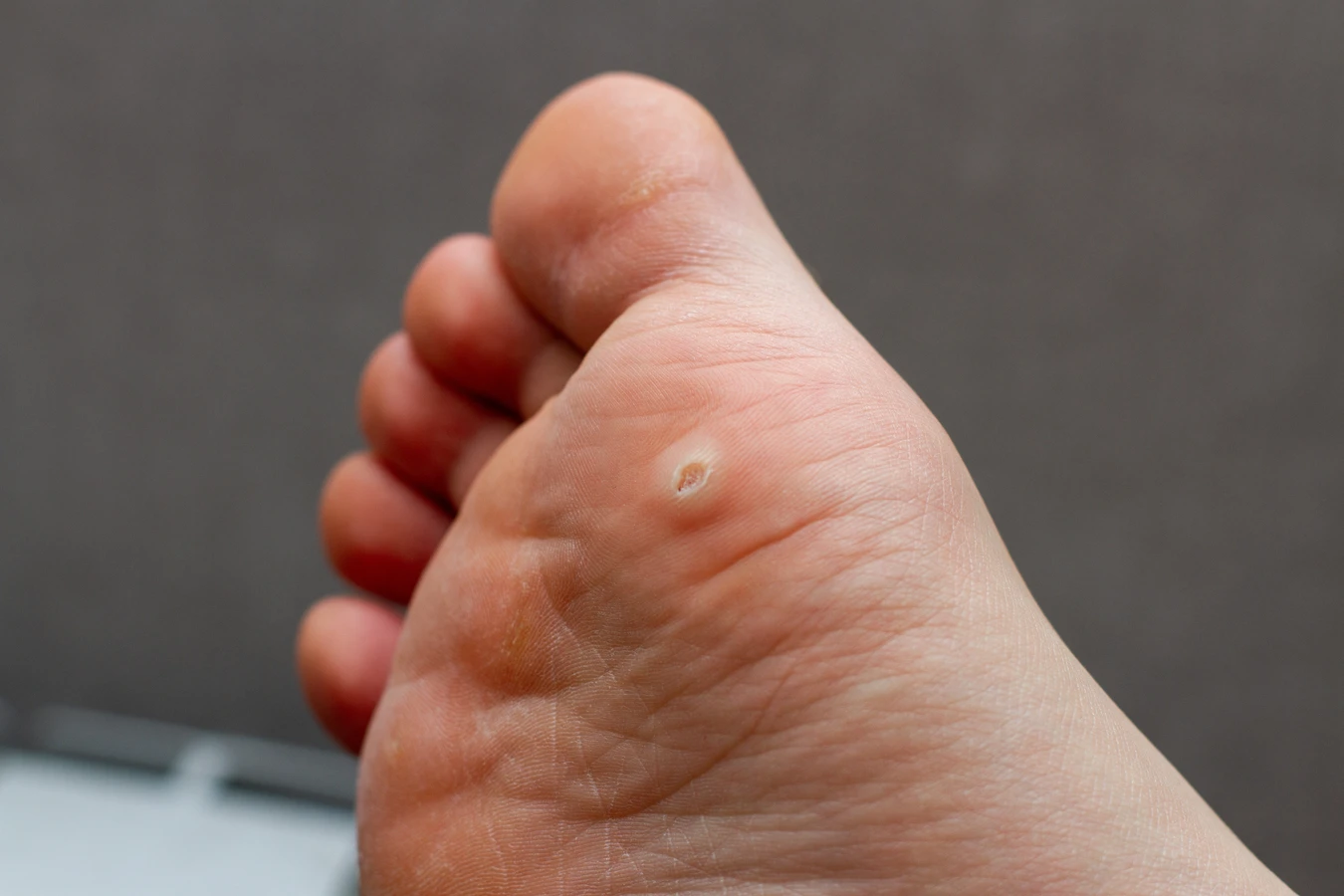 Pedicure leczniczy - czym jest i na jakie efekty możesz liczyć?