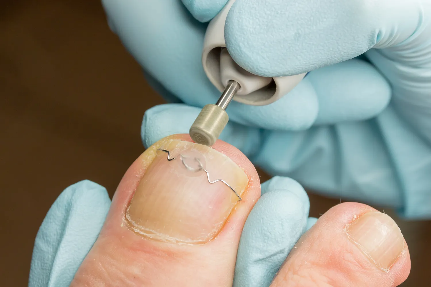 Leczymy stopy, czyli wizyta u podologa