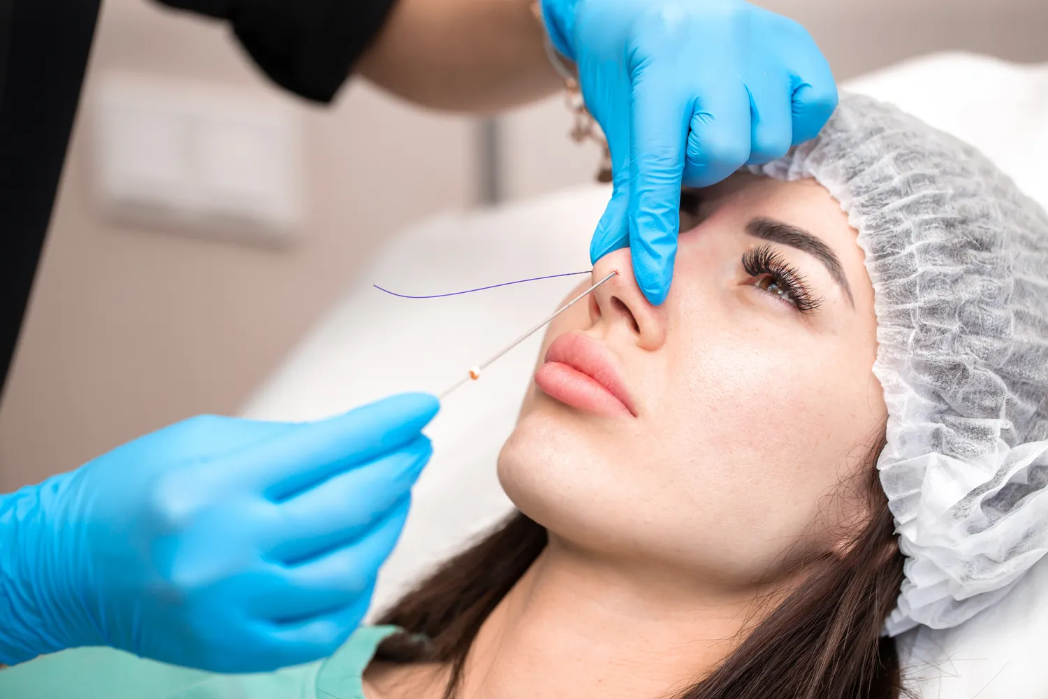 E recepta jak to wygląda?