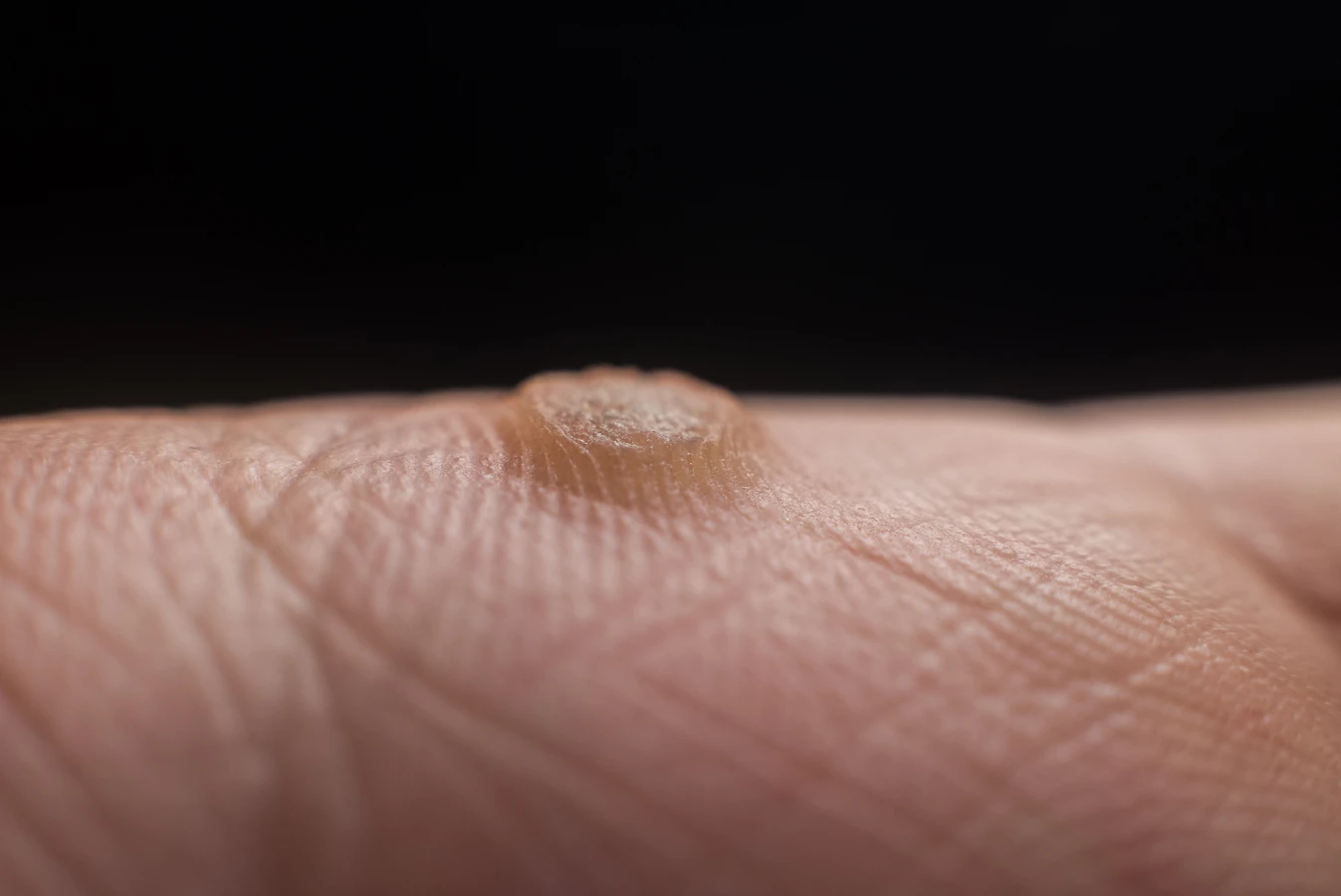 Przygotuj swoje stopy na lato - podologiczne ABC